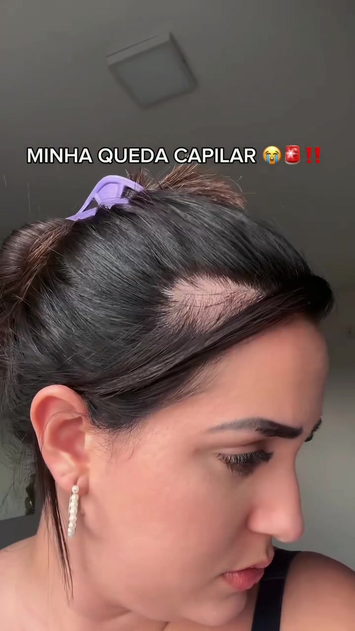 Capa do vídeo TikTok